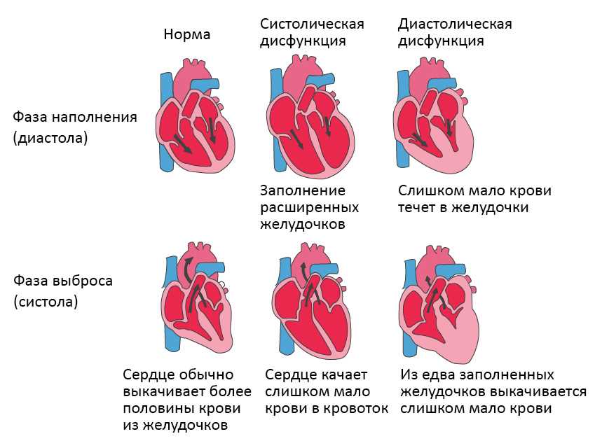 Последствия игнорирования боли в сердце при физической нагрузке