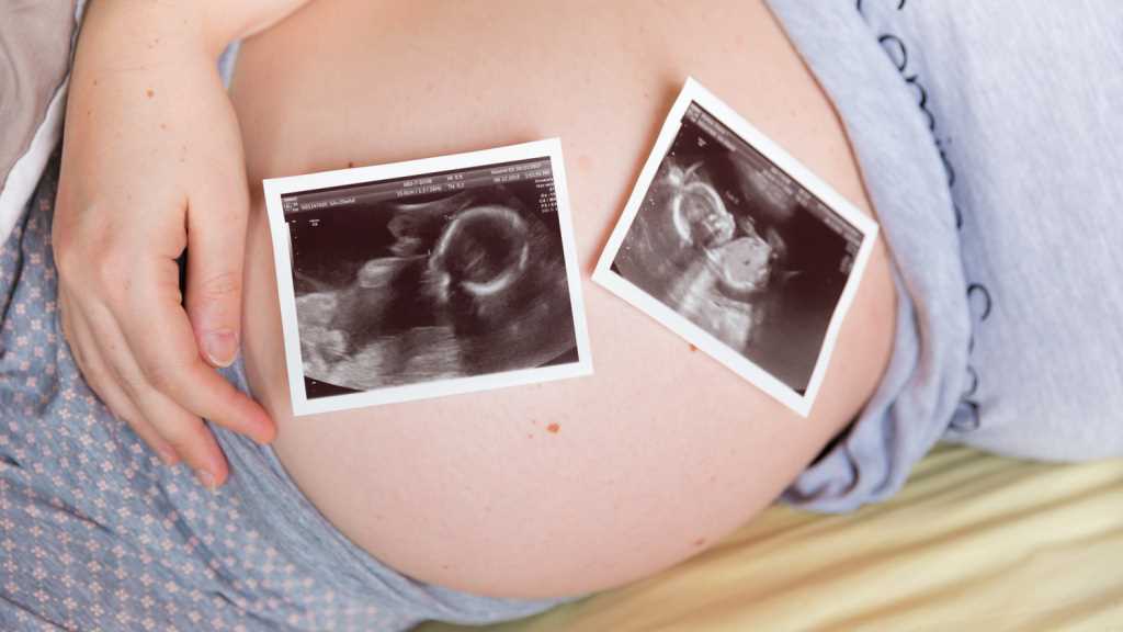 Физическая активность при беременности двойней: правила и рекомендации
