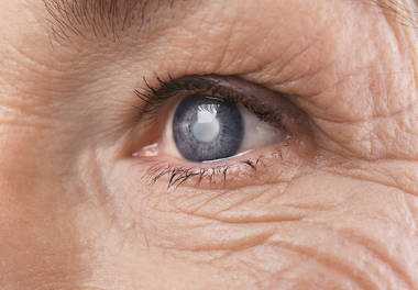 Ограничения в физической активности после операции катаракты