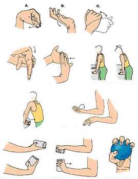 Физические нагрузки при переломах: эффективные упражнения для восстановления