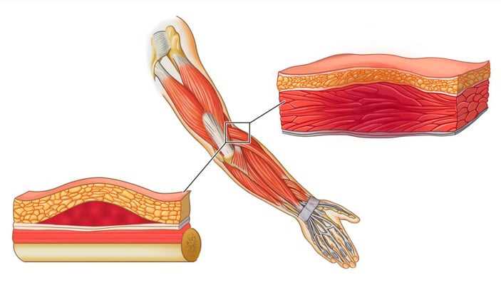 Основные причины ноющей боли в мышцах ног: от натяжения до патологических состояний