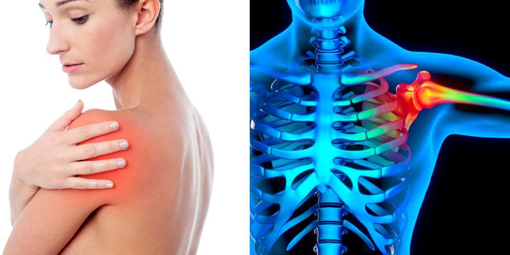 Причины и способы снятия боли в плече после физической нагрузки 