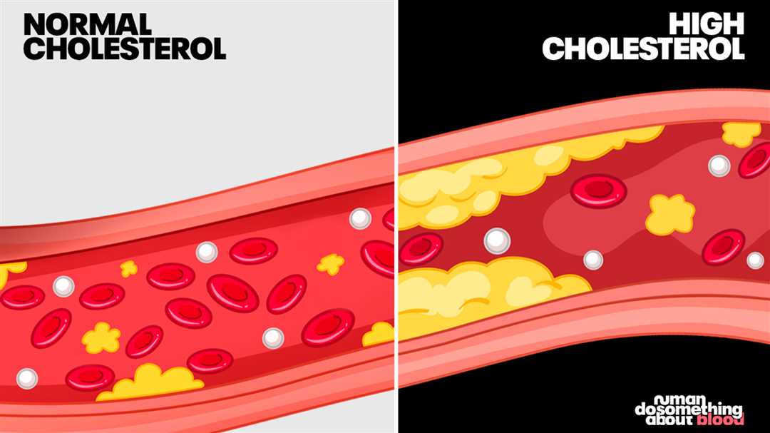 Влияние физической активности на уровень холестерина в крови: факты и рекомендации